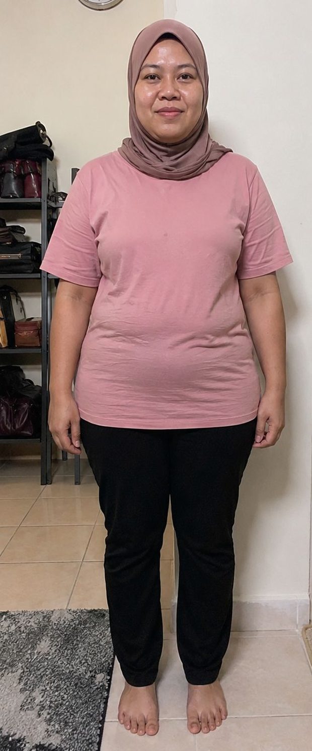 Nurul Syafiqah sebelum guna Retatrutide